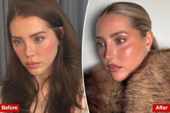 Beauty Influencer Jamie Stone Fixes K Botched Beverly Hills Rhinoplasty with Istanbul Revision Surgery
