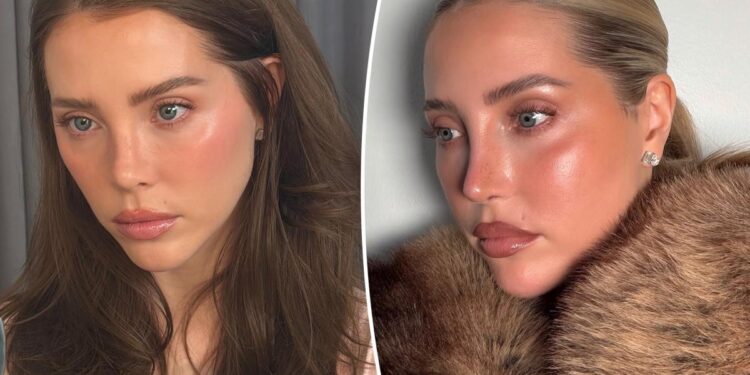 Beauty Influencer Jamie Stone Fixes K Botched Beverly Hills Rhinoplasty with Istanbul Revision Surgery Beauty Influencer Jamie Stone Fixes K Botched Beverly Hills Rhinoplasty with Istanbul Revision Surgery