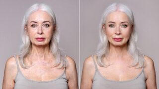 Dr. Terry Dubrow says facelift timing can make or break your results