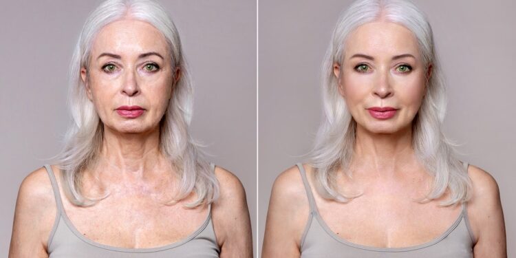 Dr. Terry Dubrow says facelift timing can make or break your results Dr. Terry Dubrow says facelift timing can make or break your results