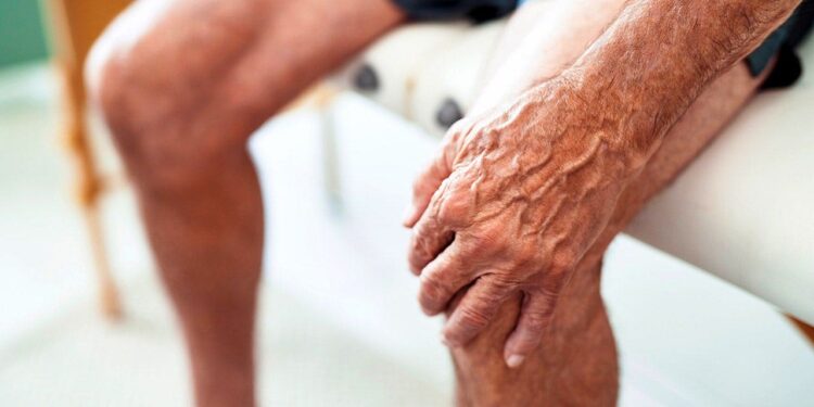 Non-surgical knee osteoarthritis procedure cut pain in 80% of patients for year