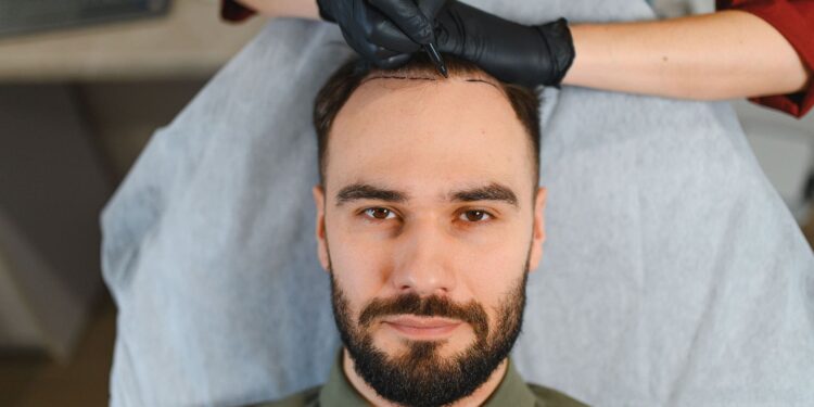 Top 10 Best Hair Transplant in Turkey Top 10 Best Hair Transplant in Turkey